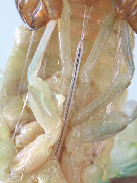 気管等の皮が抜ける様子